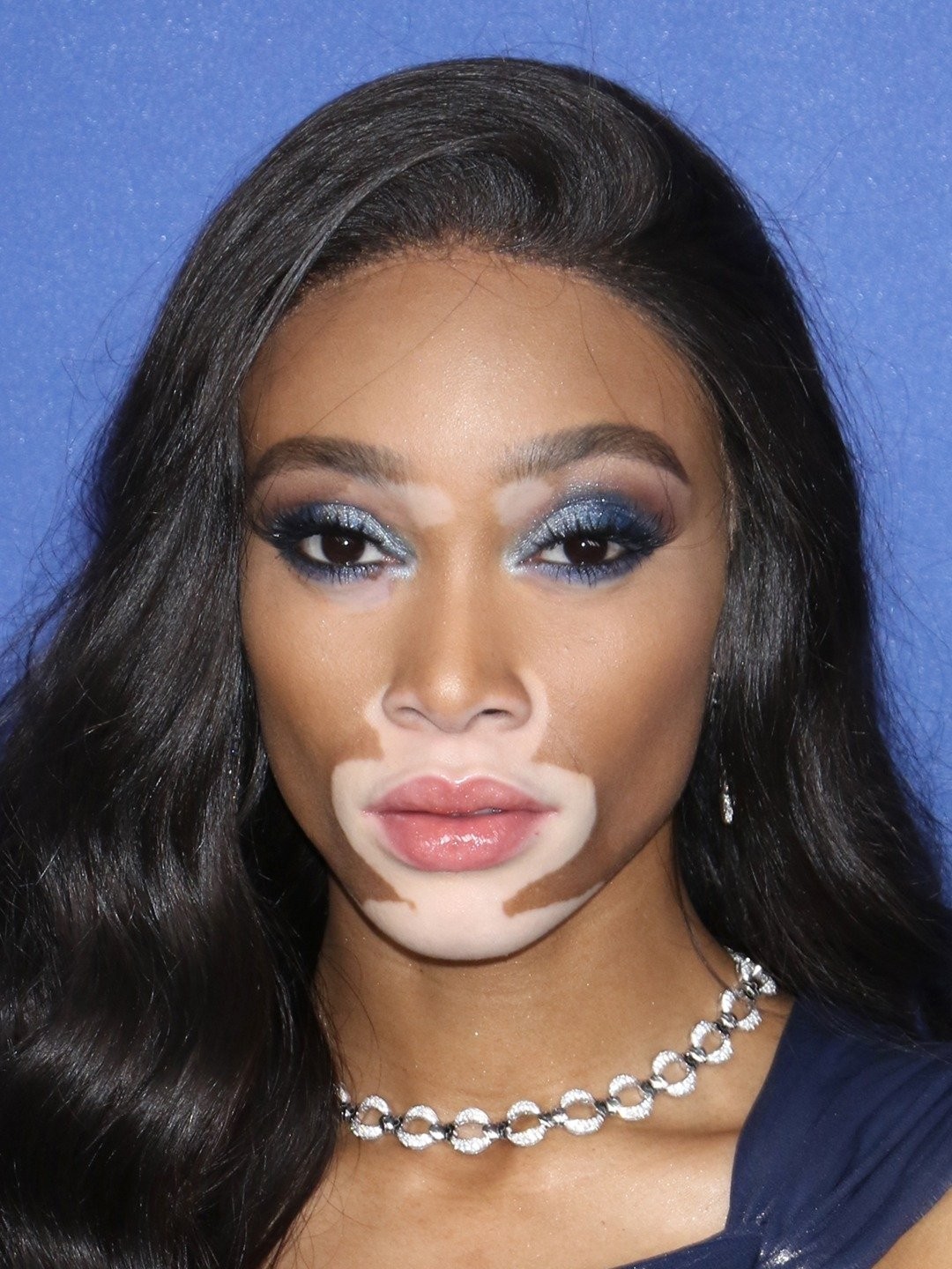 Winnie Harlow Pictures - Rotten Tomatoes