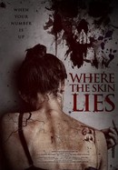 Where the Skin Lies poster image