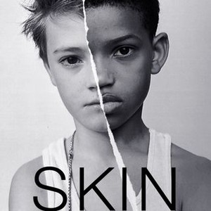 Skin (2018) photo 19
