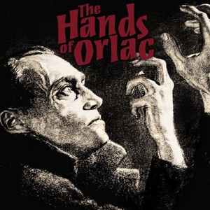 The Hands of Orlac photo 1