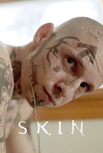Watch trailer for Skin