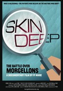 Skin Deep: The Battle Over Morgellons poster image