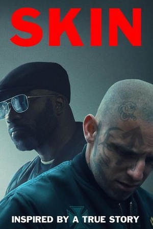 Skin poster