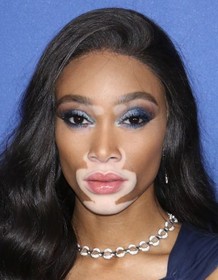 Winnie Harlow