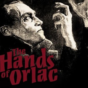 The Hands of Orlac photo 6