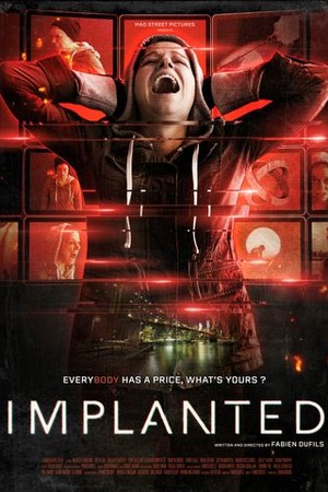 Implanted poster