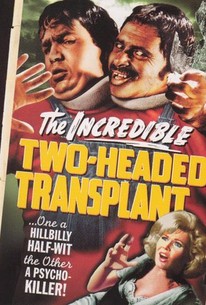 The Incredible Two-Headed Transplant