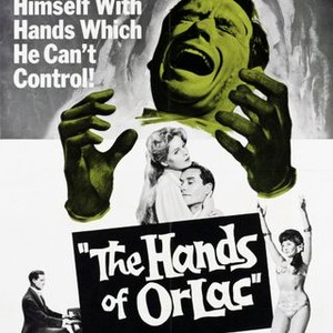 The Hands of Orlac (1960) photo 5