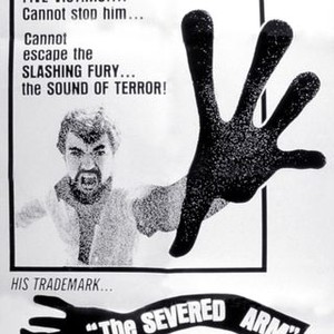 The Severed Arm photo 7