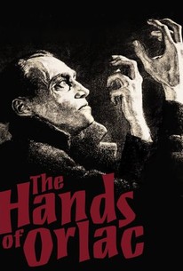 Poster for The Hands of Orlac