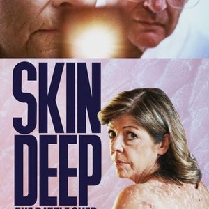 "Skin Deep: The Battle Over Morgellons photo 6"