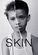 Skin poster image