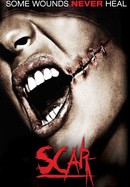 Scar poster image