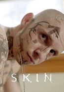 Skin poster image