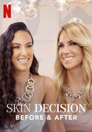 Skin Decision: Before and After poster image