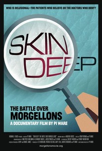 Watch trailer for Skin Deep: The Battle Over Morgellons