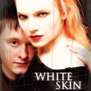 White Skin photo 12