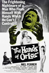 Watch trailer for The Hands of Orlac