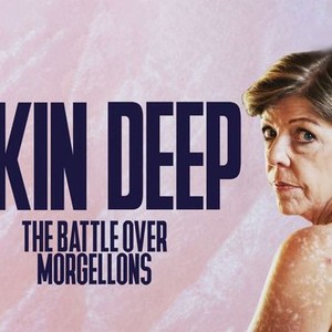 "Skin Deep: The Battle Over Morgellons photo 5"