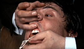 Marathon Man: Official Clip - I'm Not Going Into That Cavity