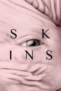 Poster for Skins