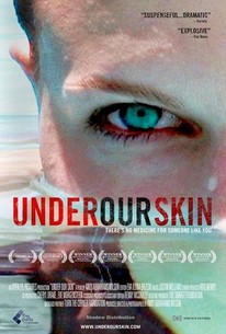 Under Our Skin | Rotten Tomatoes