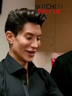 Botched season 1 episode 1 full episode online