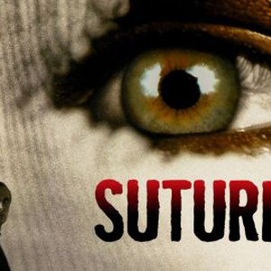"Suture photo 4"