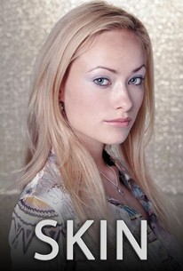 Skin Season 1 Episode 2 Rotten Tomatoes