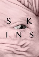 Skins poster image