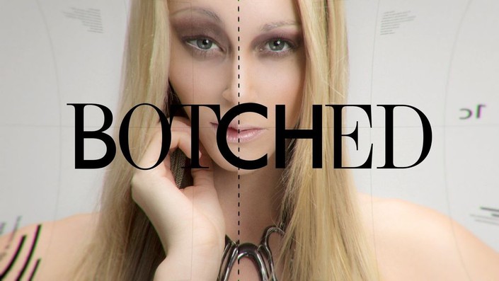Botched full episodes dailymotion store