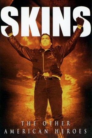 Skins poster