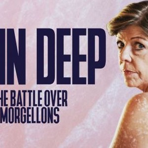 "Skin Deep: The Battle Over Morgellons photo 8"