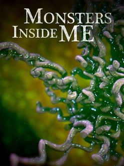 Monsters Inside Me: Season 3, Episode 7 | Rotten Tomatoes