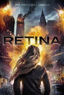 Retina poster