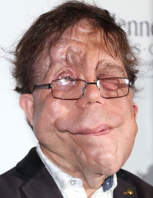 Adam Pearson Rotten Tomatoes