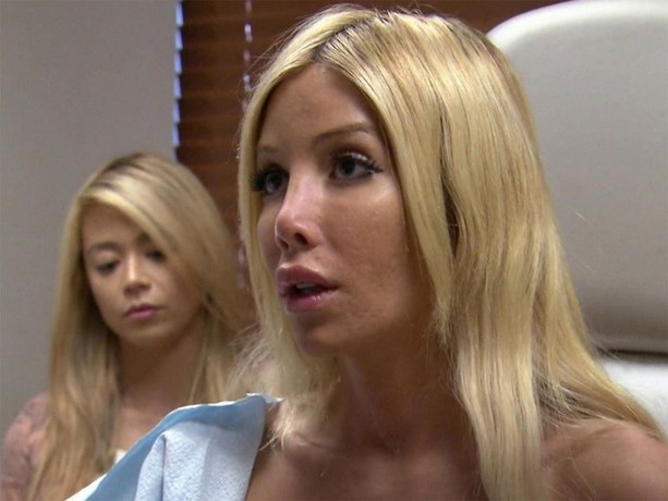 Botched full episodes 123movies 2025