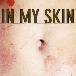 In My Skin photo 14