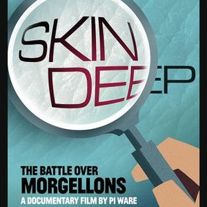 "Skin Deep: The Battle Over Morgellons photo 12"